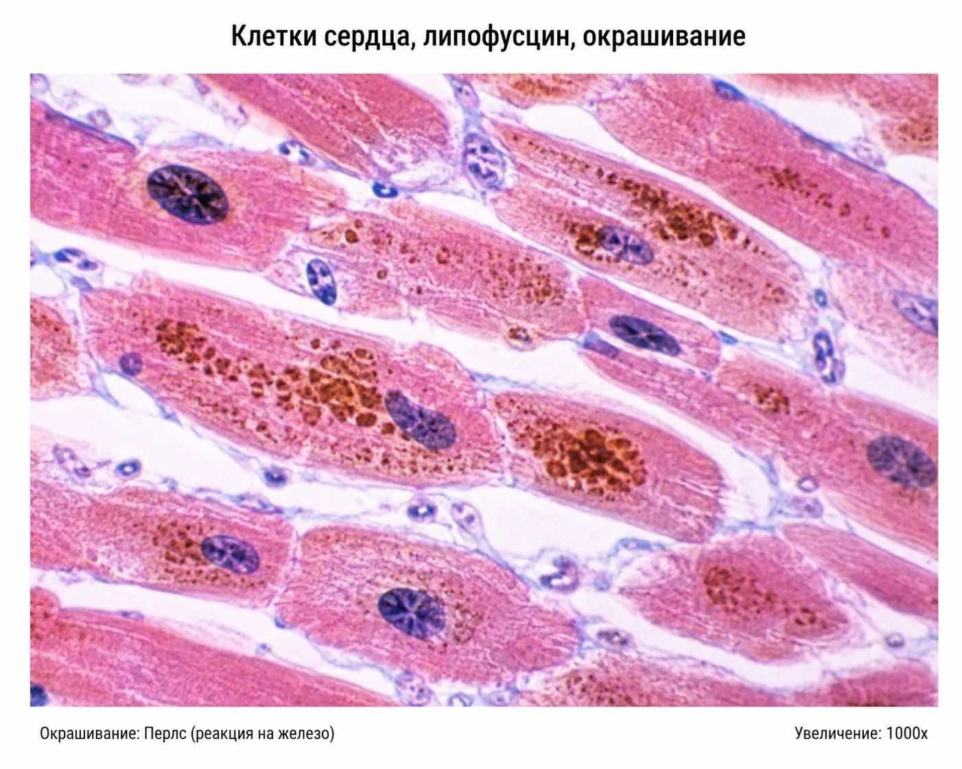 Микрофотография клеток сердца, липофусцин, окрашивание